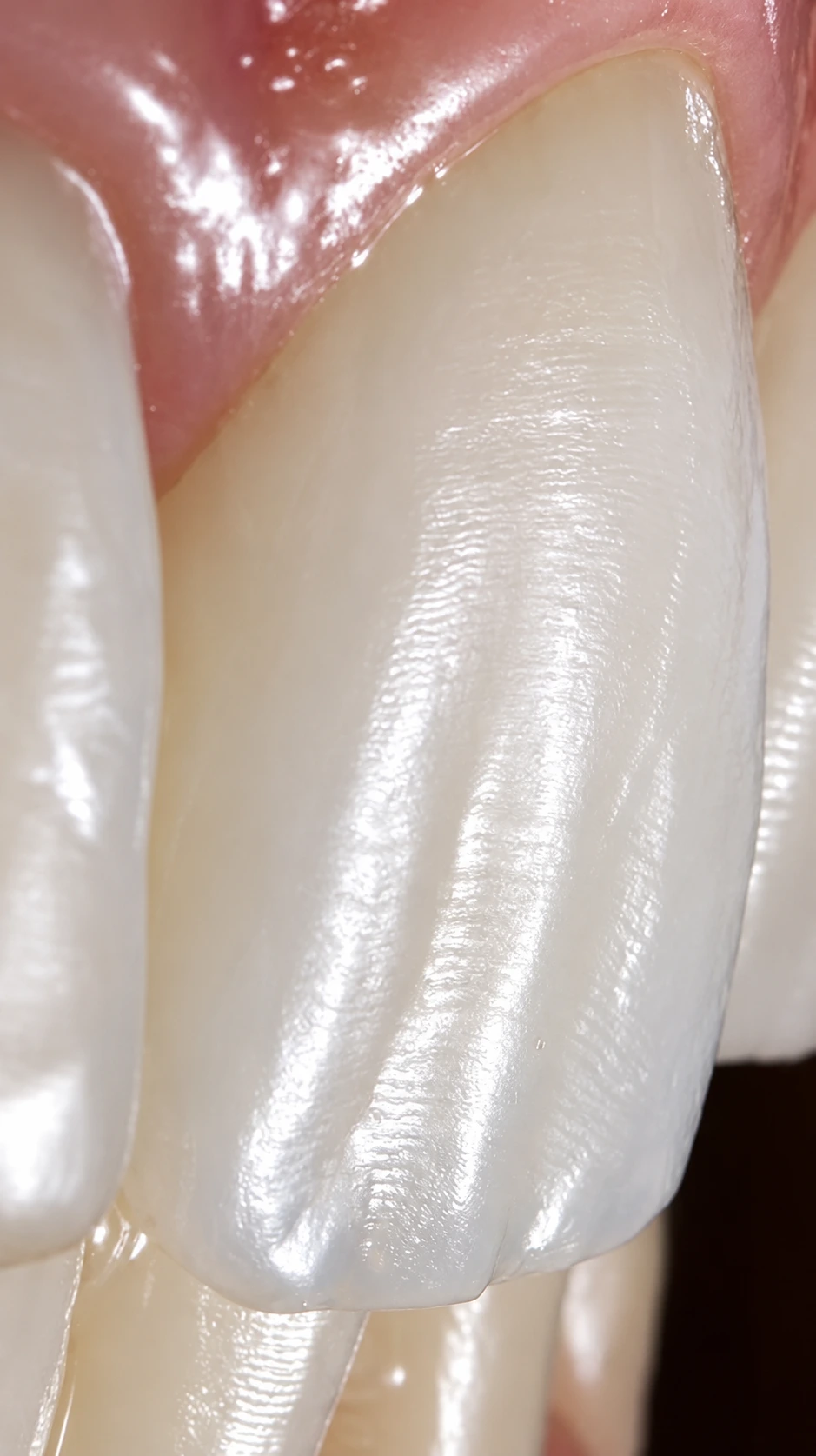 Vue macro de l’émail de dents naturelles — photographie retouchée