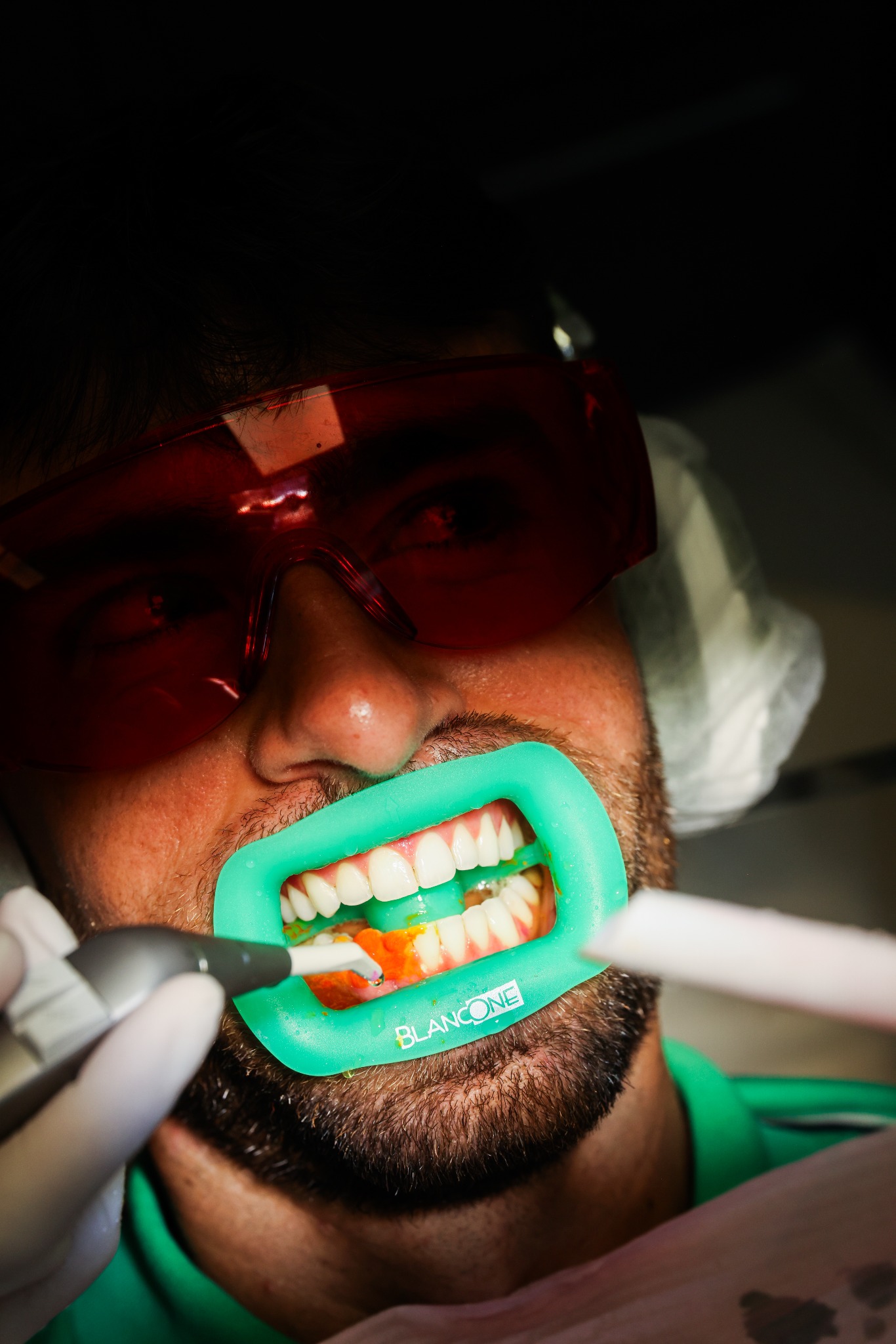 Fin de la séquence clinique BlancOne CLICK+